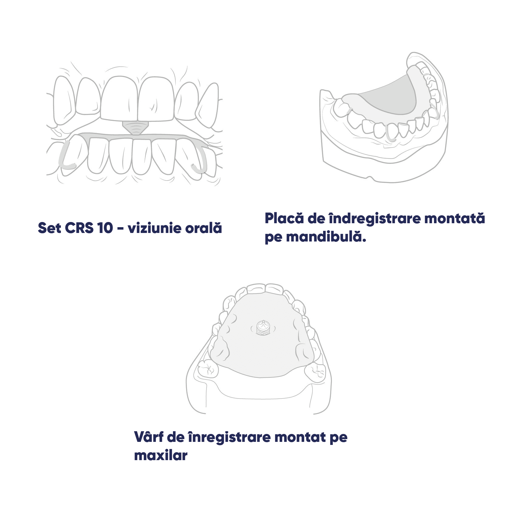 instructiuni pentru set crs 15