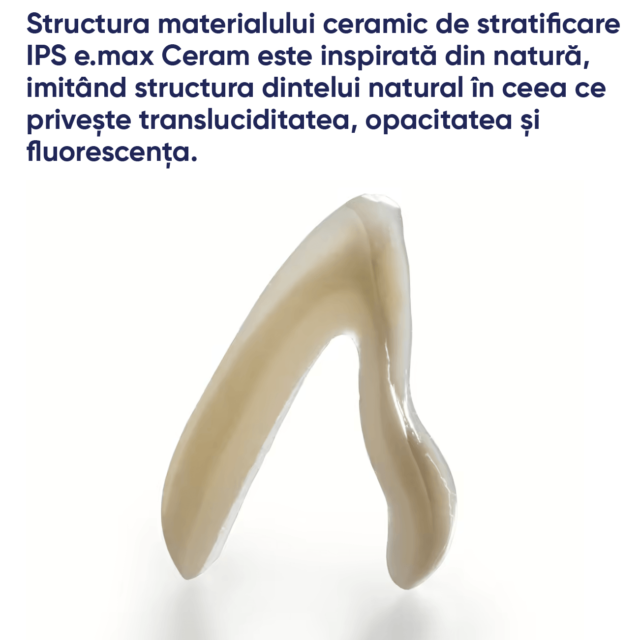 un avantaj si un exemplu de lucrare realizata cu ceramica IPS e.max Ceram Ivoclar