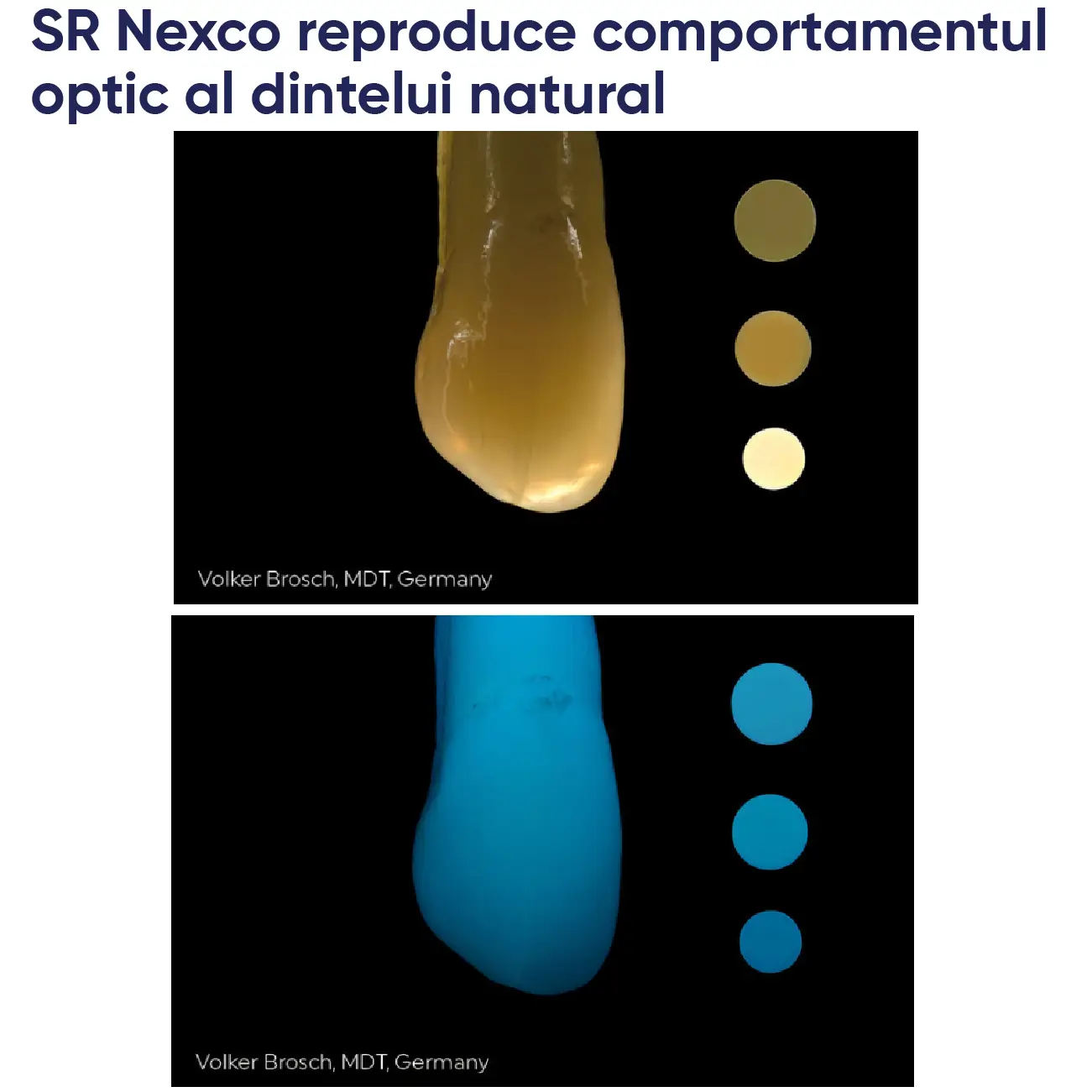 exemplu de similaritate cu naturalul in cazul unei restaurari cu SR nexco