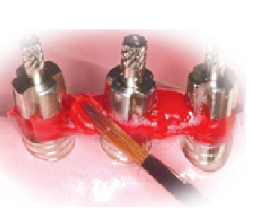 acrilat novoplast