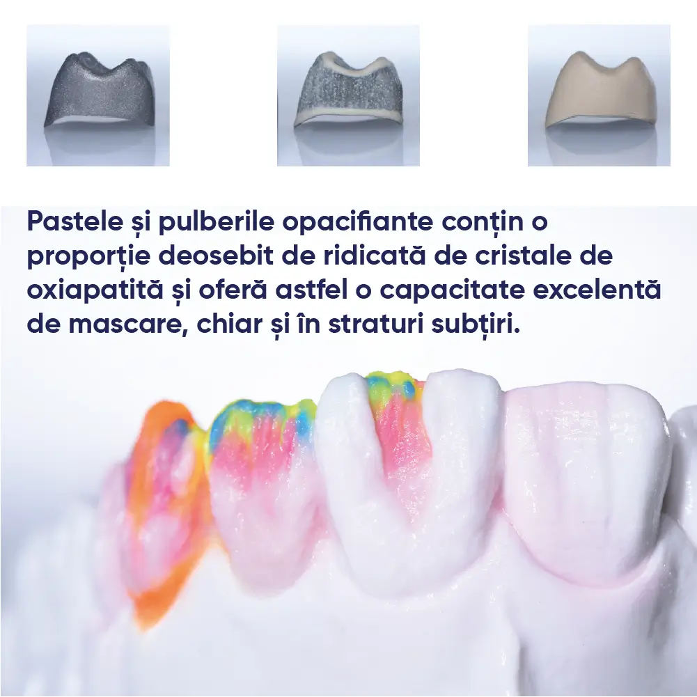 informatii legat de stratificare pentru ceramica IPS style ceram