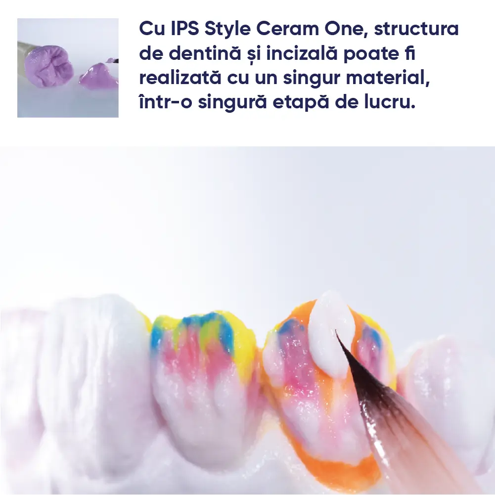 pensula ce pune ceramica IPS style ceram pe lucrarea dentara in tehnica de stratificare