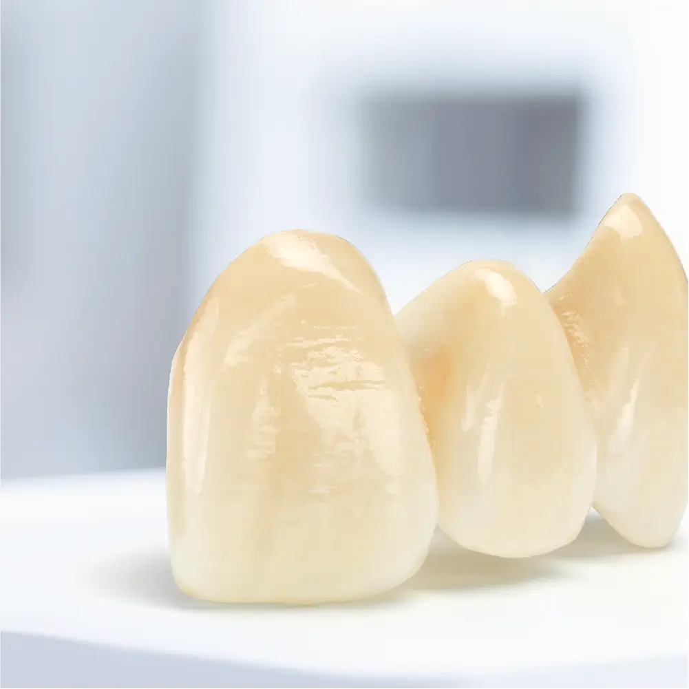 puncte de 3 elemente dentare realizata cu ceramica IPS style ceram,