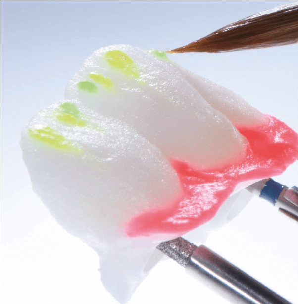 stratificare cu ajutorul pensulei folosind o ceramica ivoclar ips e.max