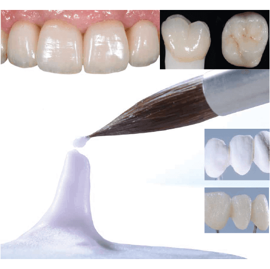 ceramica ips style - in curs de utilizare si cu restaurari realizate cu succes