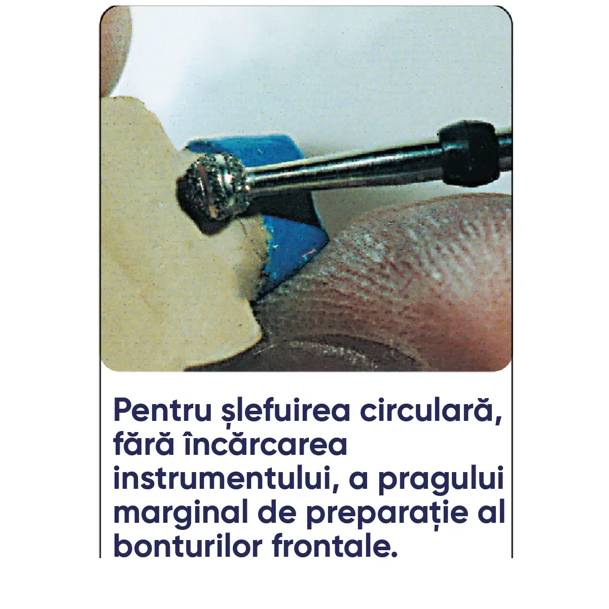 freza diamantata plasturbo mini specificatii si utilizare