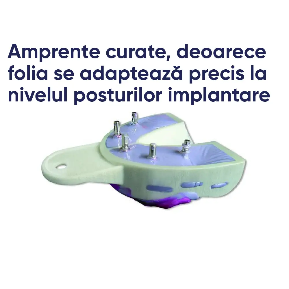 exemplu de amprentare si informatii legat de miratray implant