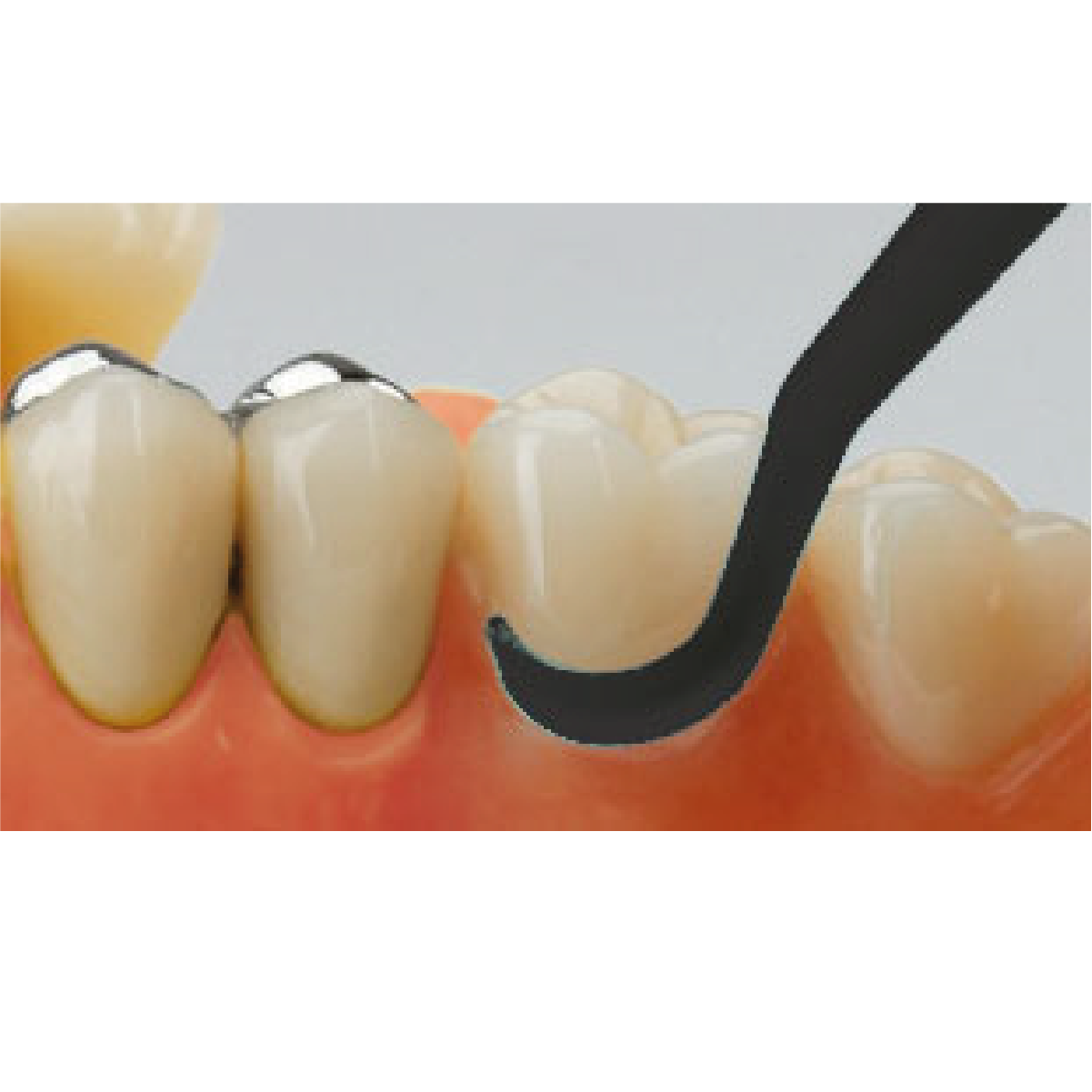 utilizare instrument pentru curatare miraclean black