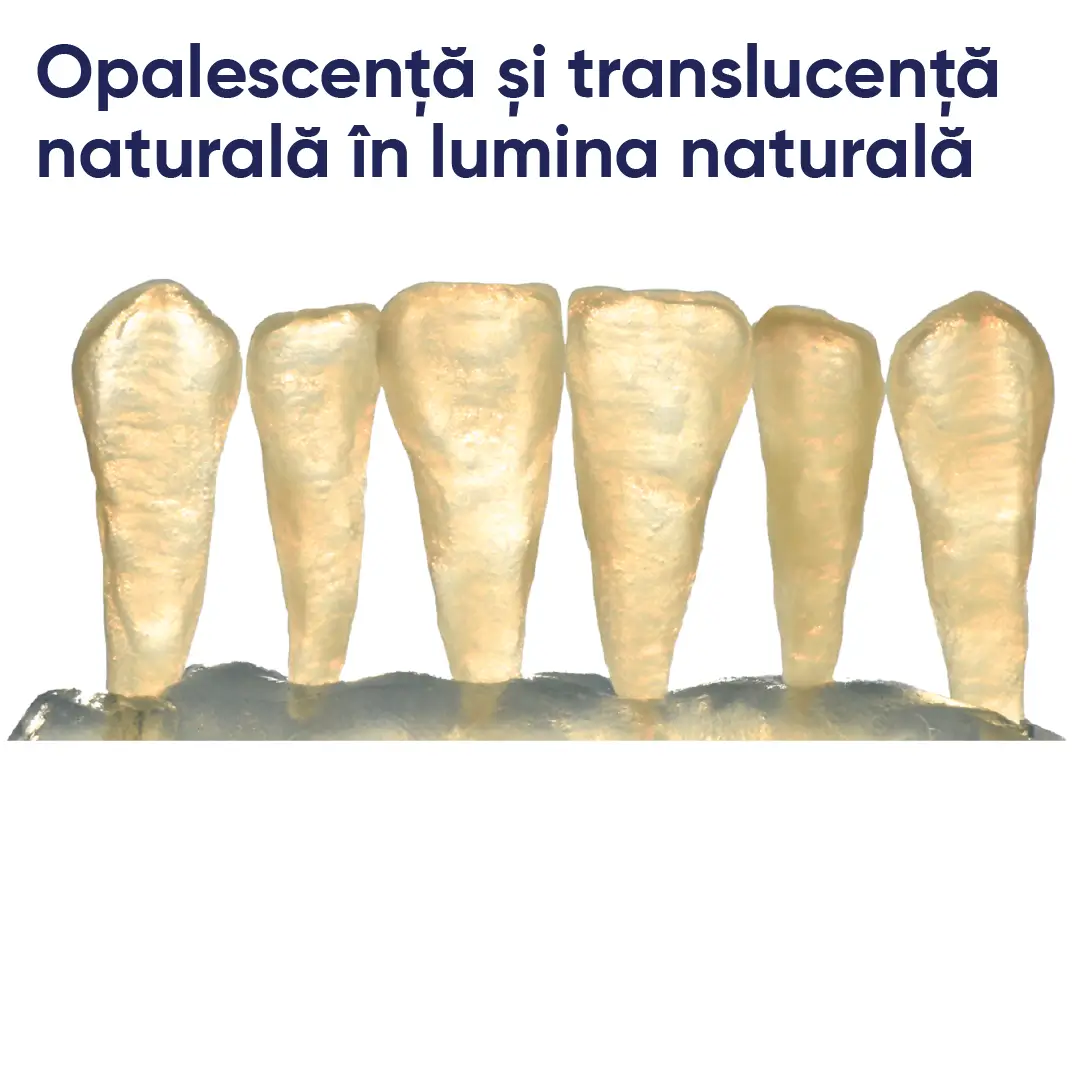 opalescenta si naturaletea ceramicii cu ingoturile celtra press dentsply sirona
