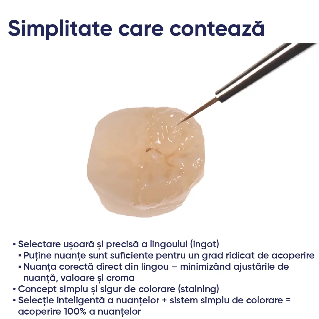 lucrare realizata cu ingotul de ceramica Celtra Press si informatii despre nuante