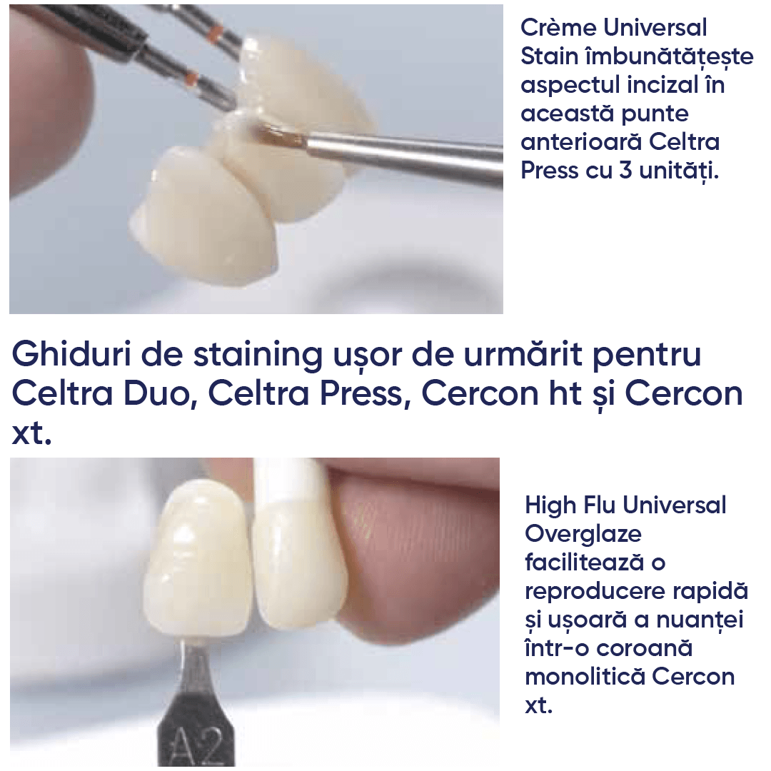 exemplu de lucrari si de informatii referitoare la utilizarea ceramicii Dentsply Sirona