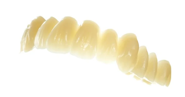 exemplu de lucrare realizata cu ajutorul unui disc PMMA Dentsply Sirona
