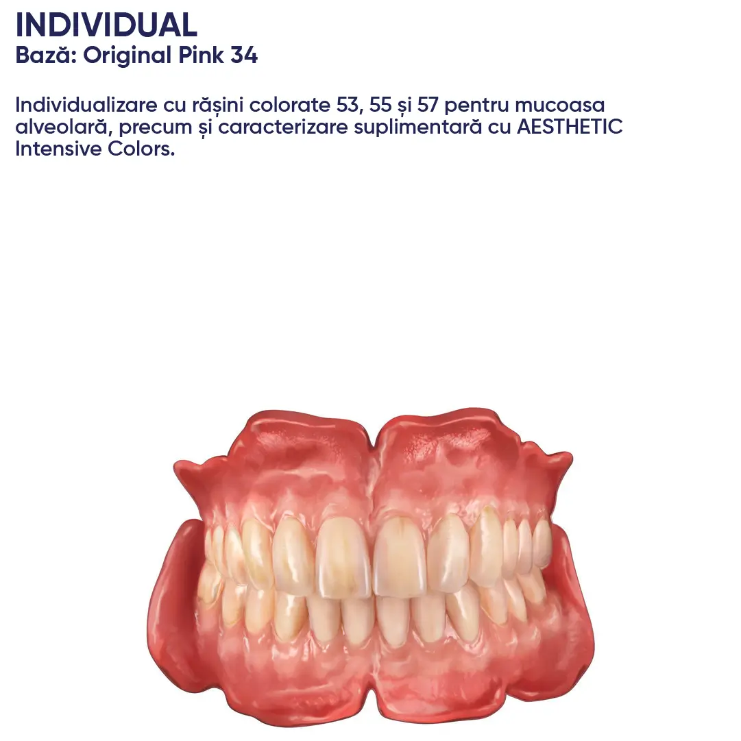 exemplu de proteza dentara in care s-a utilizat individualizarea cu produsele candulor