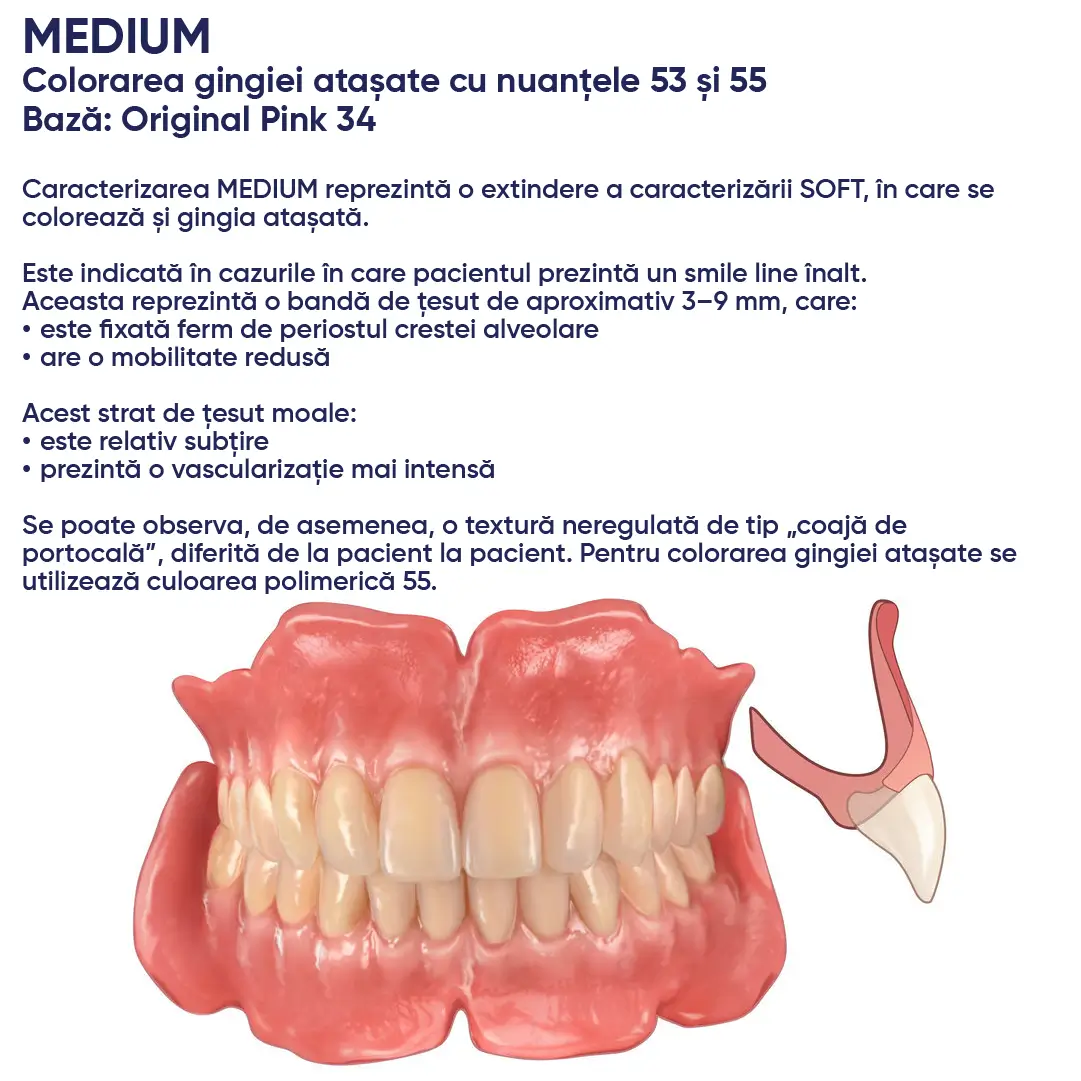 informatii si ilustrarea exemplului de utilizare a individualizarii si a personalizarii unei proteze cu materialele si acrilatele candulor