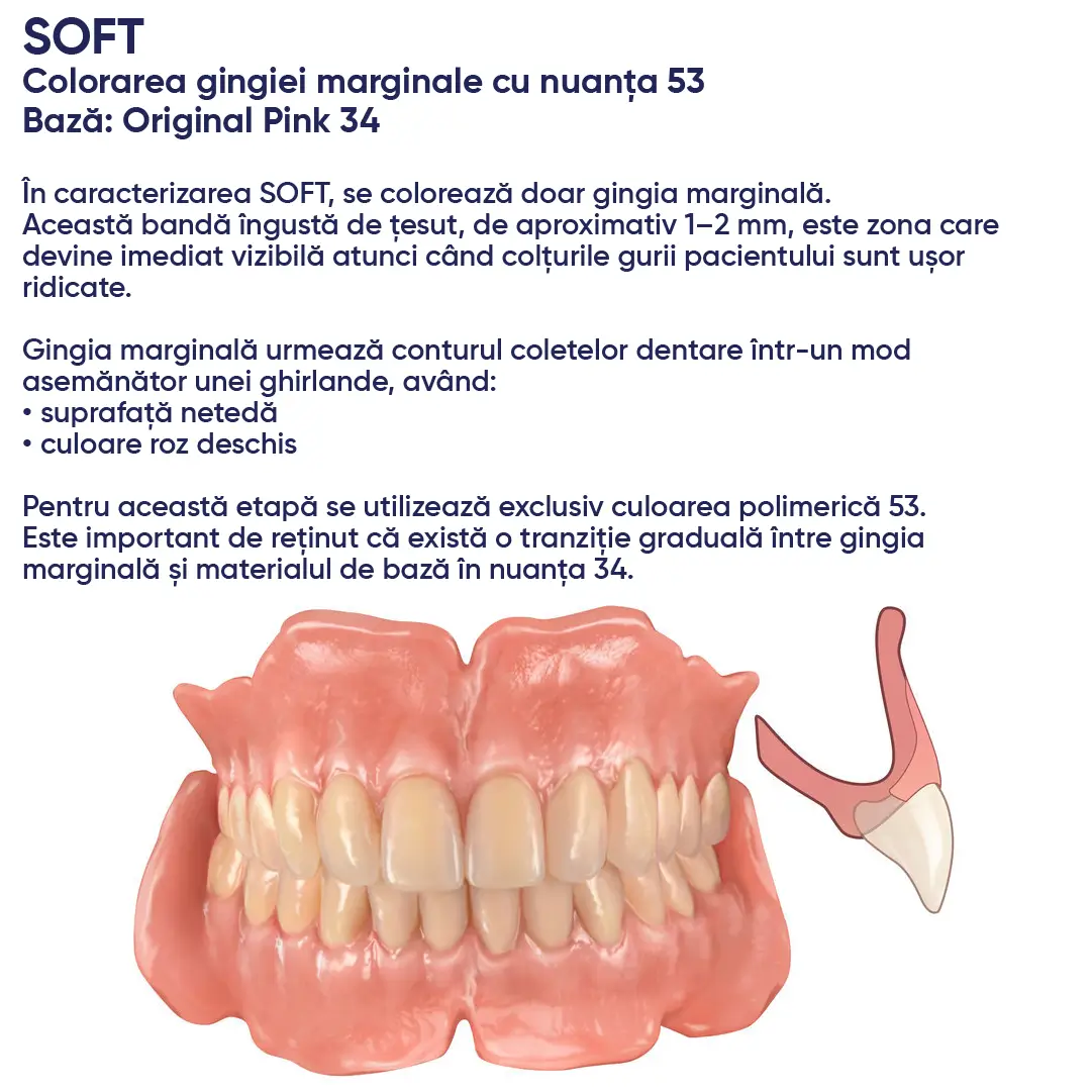 individualizarea slaba a unei proteze realizata cu acrilatul candulor