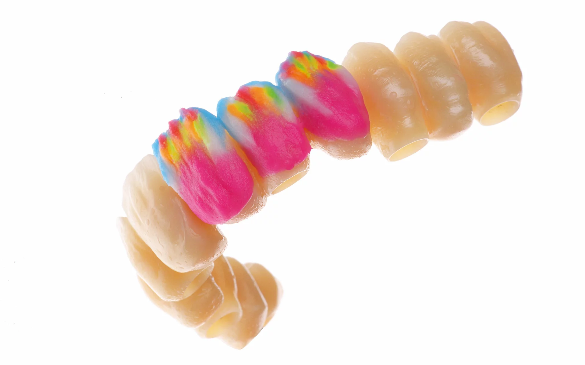 Lucrare realizata dintr-un disc de zirconiu folosind tehnica CAD-CAM din laboratorul dentar