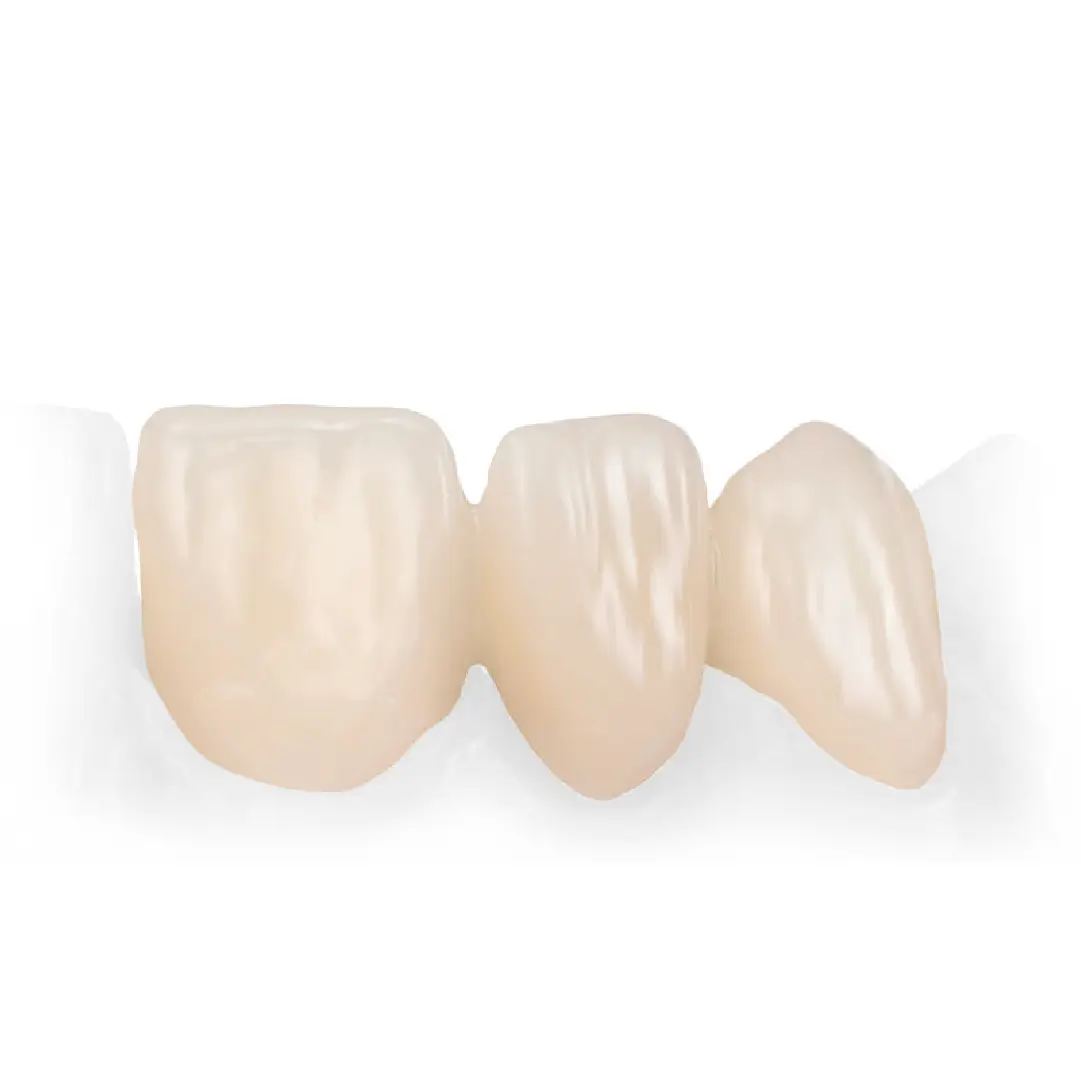 lucrari din zirconiu realizate din discul cercon xt ml