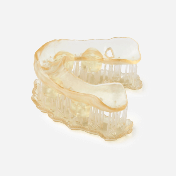 exemplu de lucrare cu surgical guide