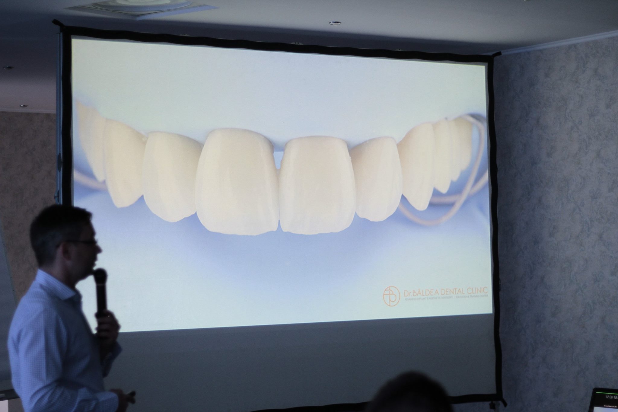 13071966 507854856068757 7145667233858837527 o | Restaurarea protetică a dinţilor cu tratament endodontic