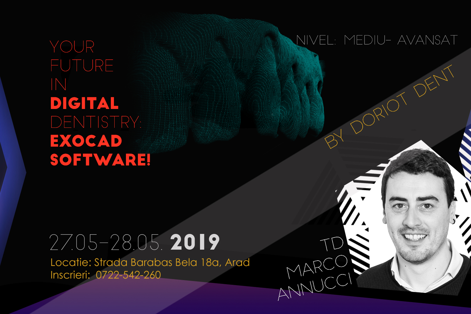 EXOCAD 2 | Your Future in Digital Dentistry: Exocad Software