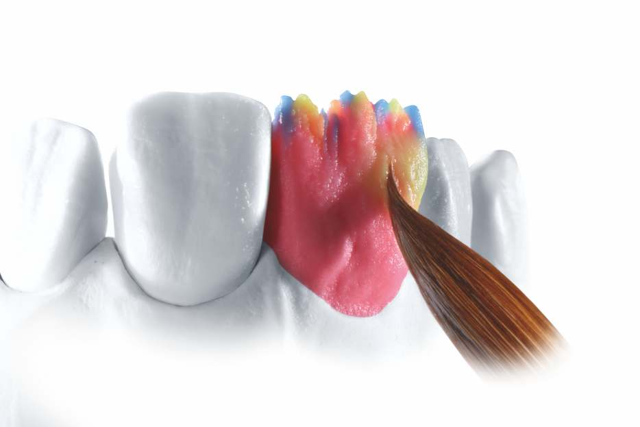 Page 1 Image 1 | IPS e.max Ceram Selection - Un Concept inspirat din Natura