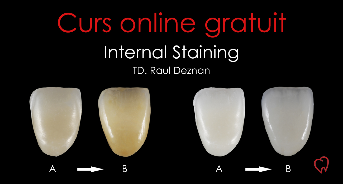 Untitled 1 | WEBINAR GRATUIT - Internal staining de la A la B