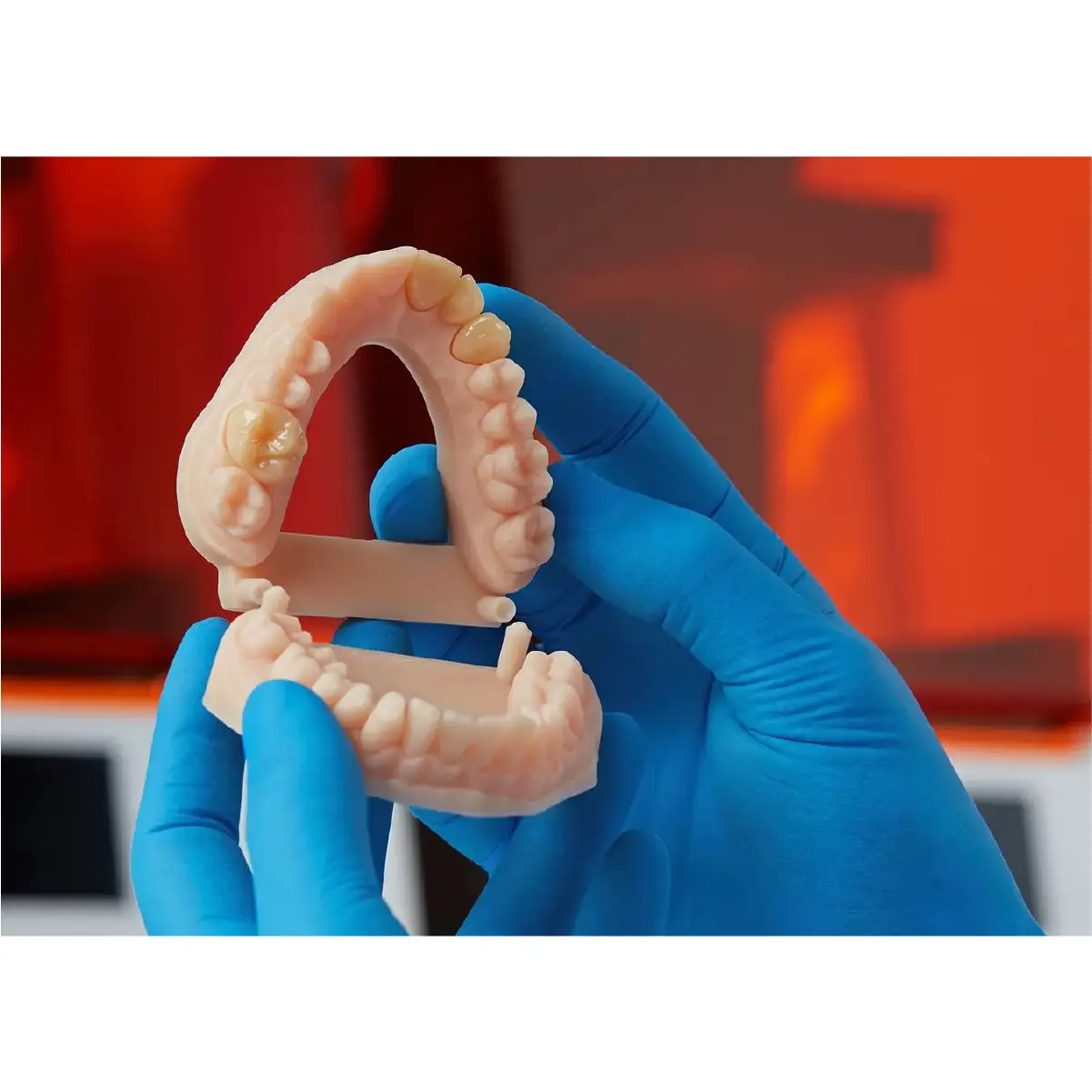 doua maini inmanusate tin o lucrare dentara printata 3D cu rasina dental model v3 formlabs