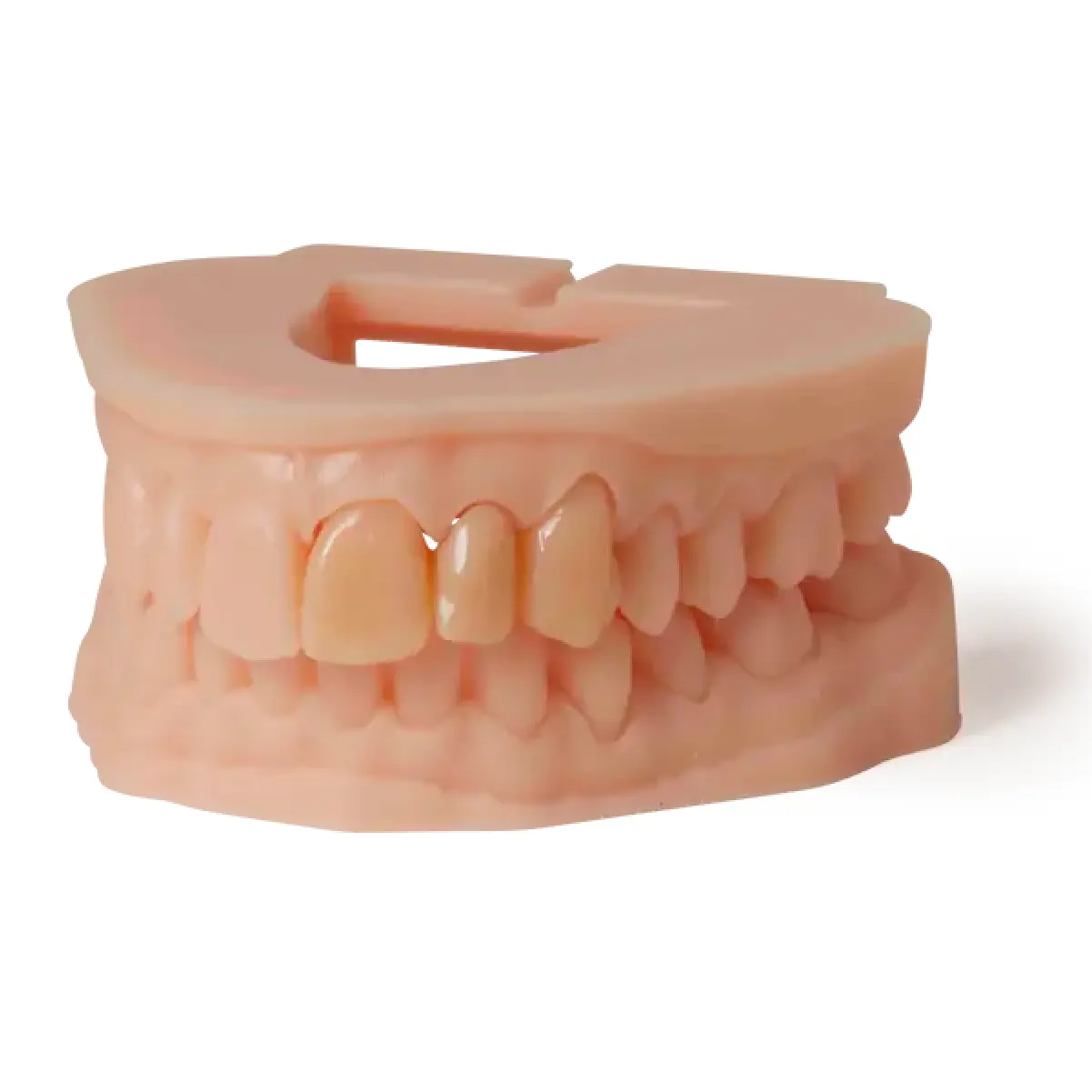 exemplu de lucrare realizata cu rasina dental model V3 formlabs