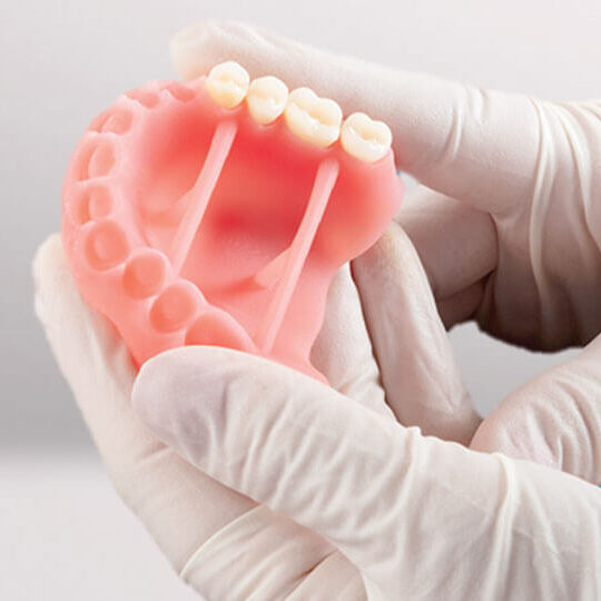 exemplu de printare 3D cu rasina lucitone in laboratorul de tehnica dentara