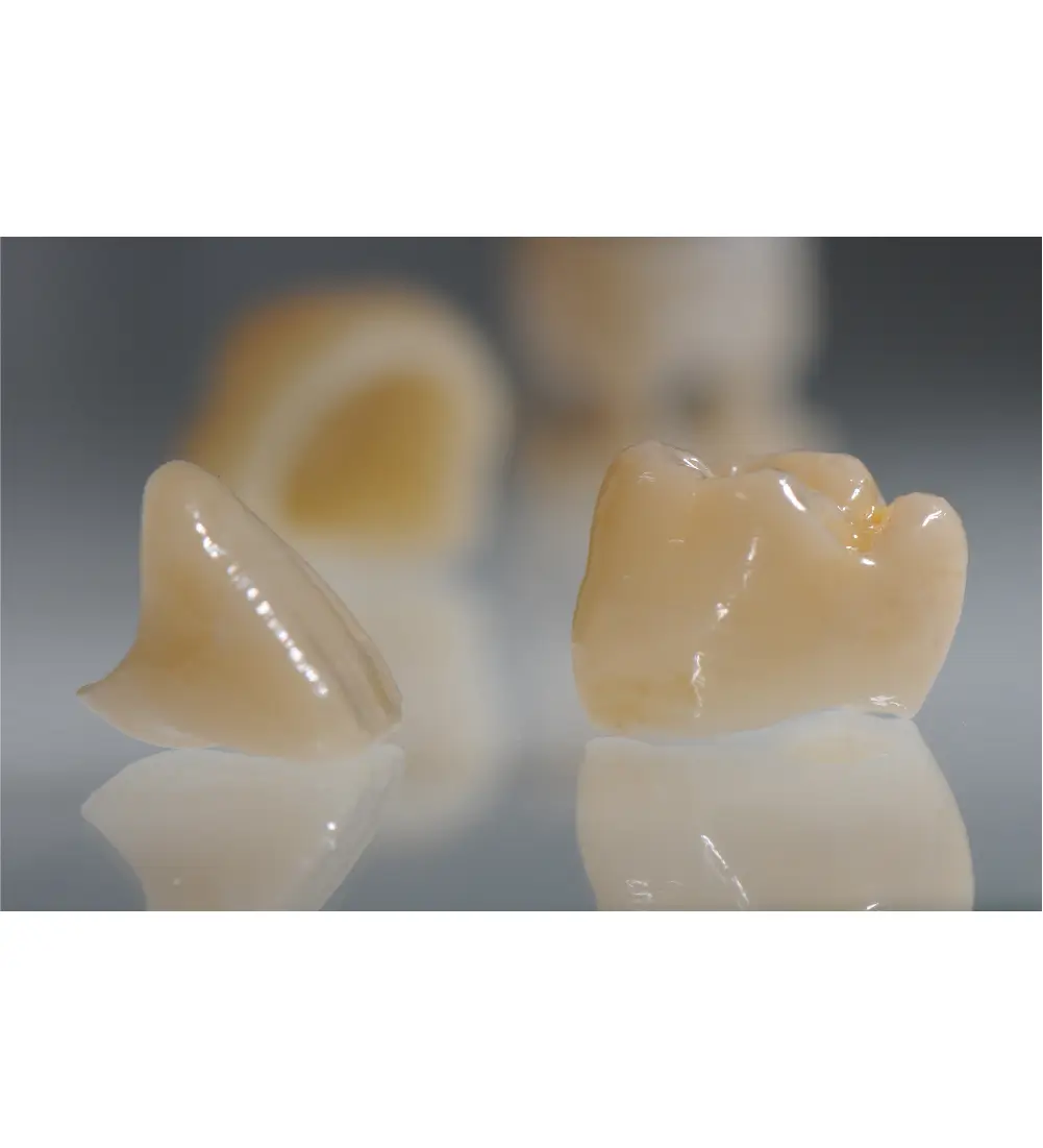 coroane dentare printate 3D in laboratorul de tehnica dentara cu rasina VarseoSmile Crown bego