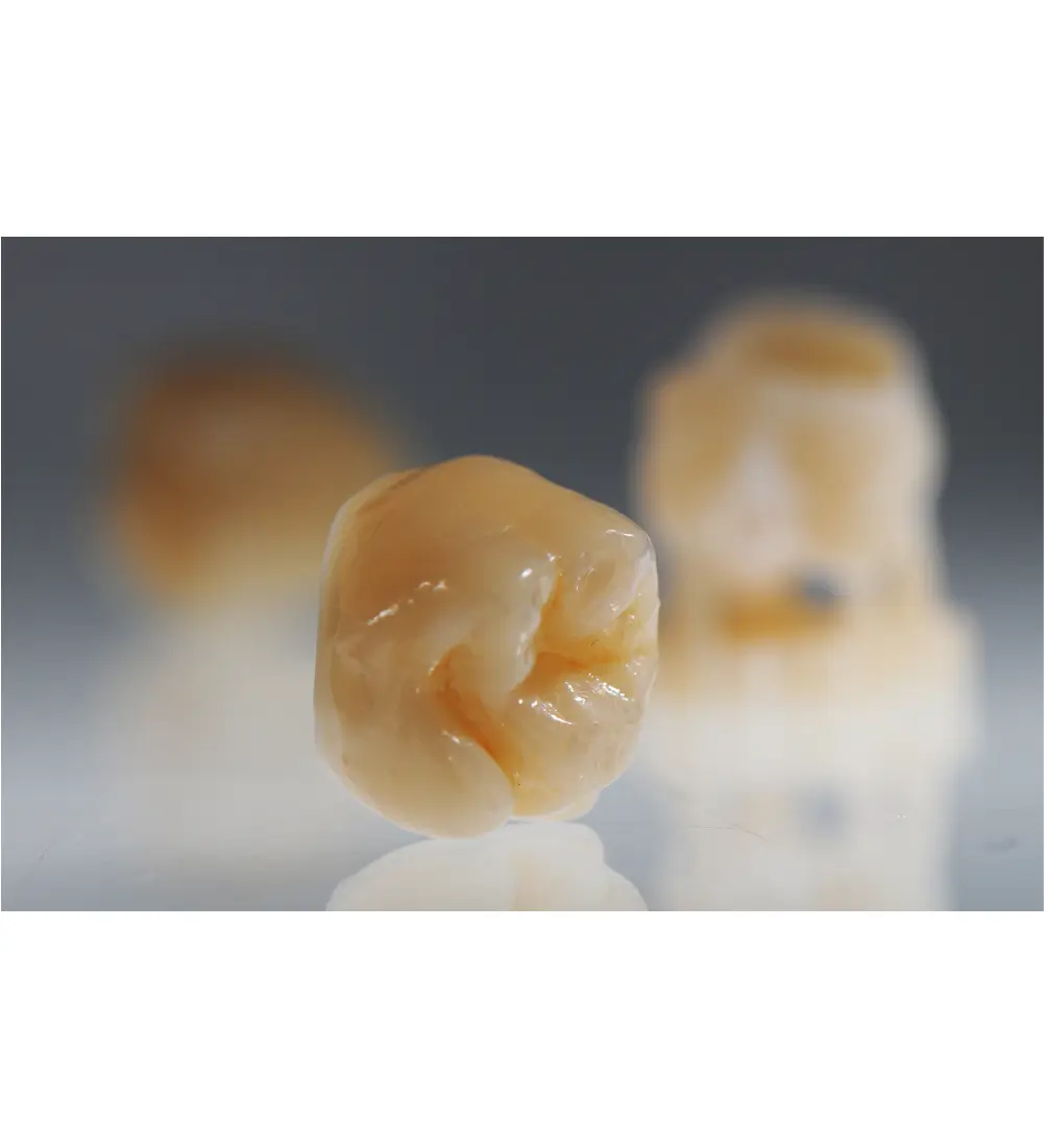 coroana dentara printata 3D in focus cu rasina Bego VarseoSmile Crown in laborator de tehnica dentara