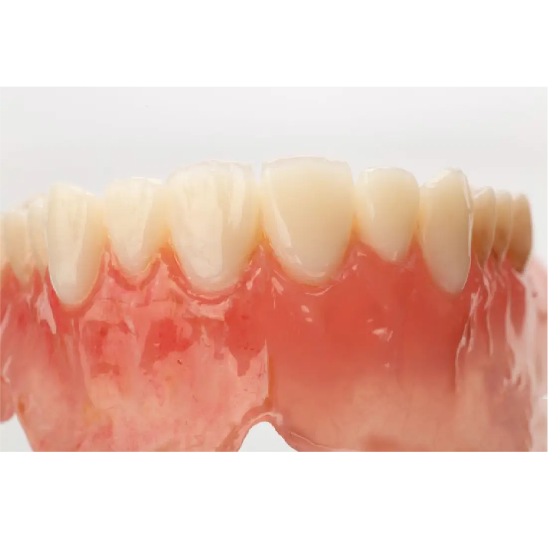 dinti printat 3D cu rasina VarseoSmile bego in laborator de tehnica dentara