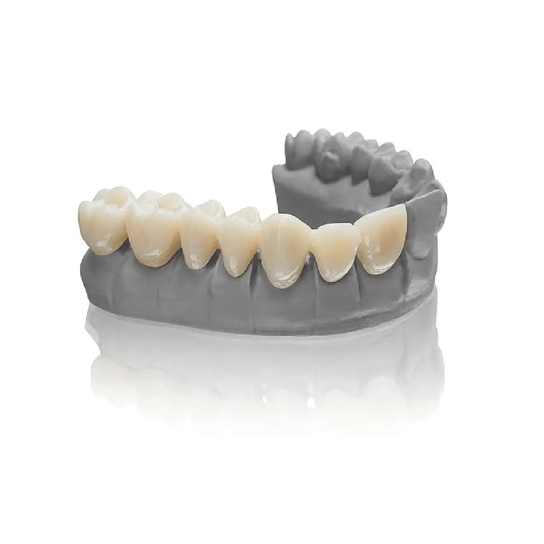 exemplu de dinti realizati cu rasina bego varseosmile temp pe model