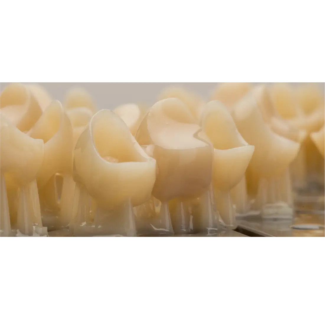 dinti printati 3D in laborator de tehnica dentara