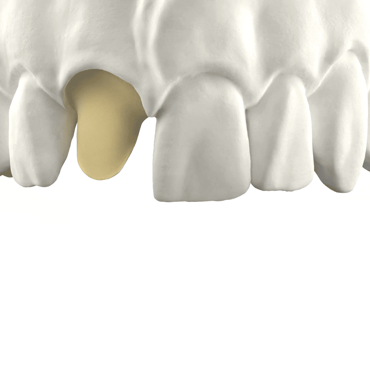 model pentru printare 3D cu rasina Inovaprint