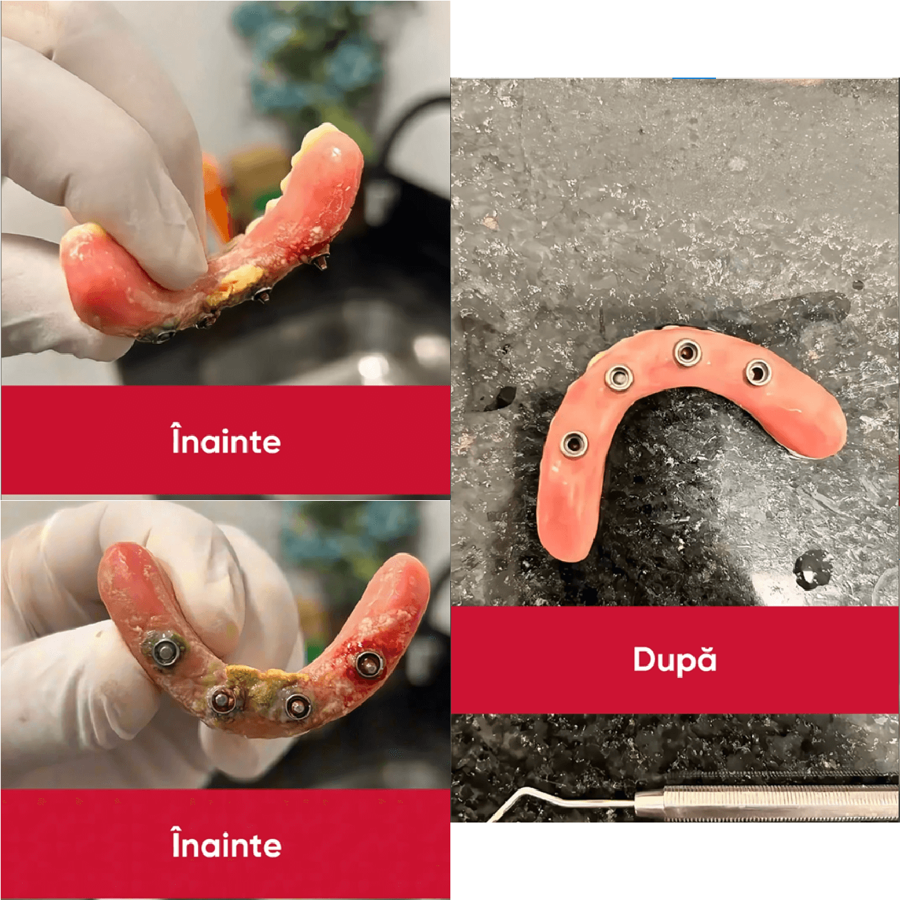 proteza curatata cu aparatul sympro