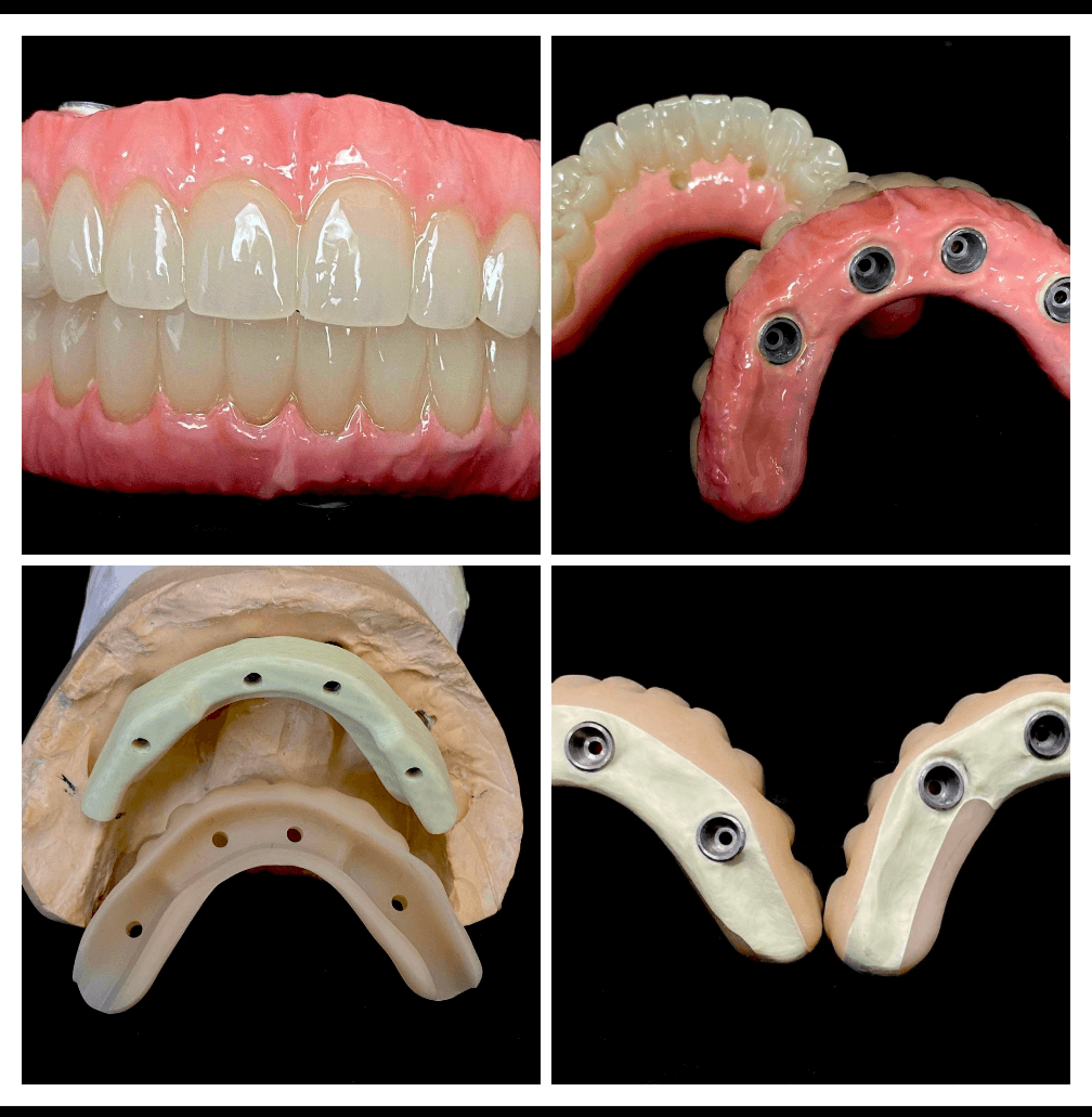 exemplu de lucrari cu materialul ceramica hibrida ambarino