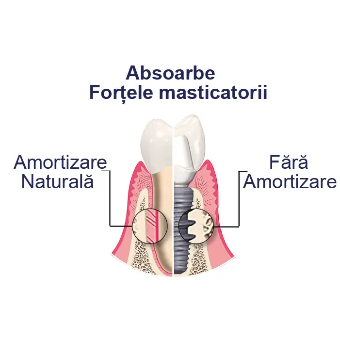 specificatii si beneficii ale discului de ceramica hibrida ambarino pentru absorbtia fortelor masticatorii