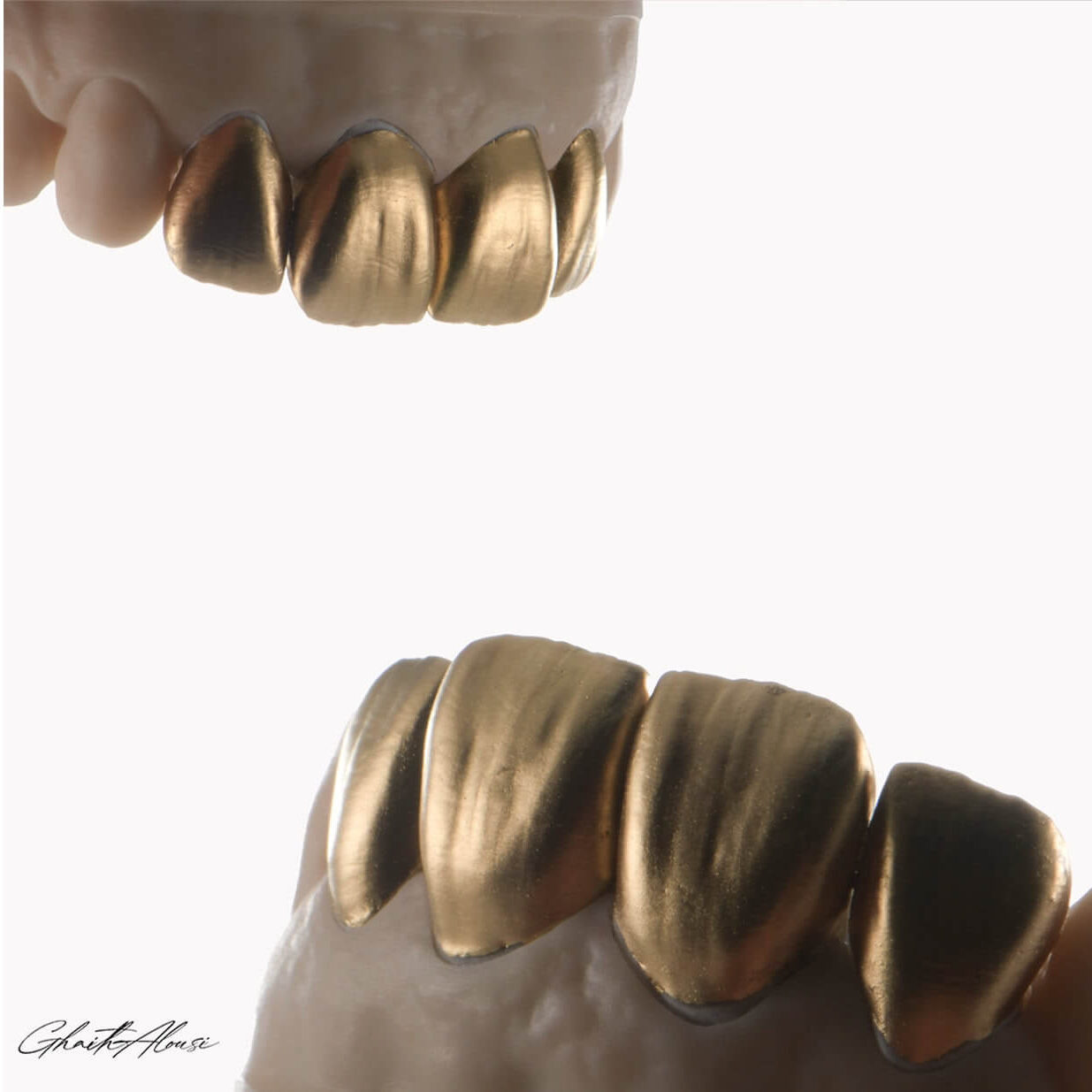 lucrare realizata cu discul refractat TriVest CAM in laboratorul de tehnica dentara