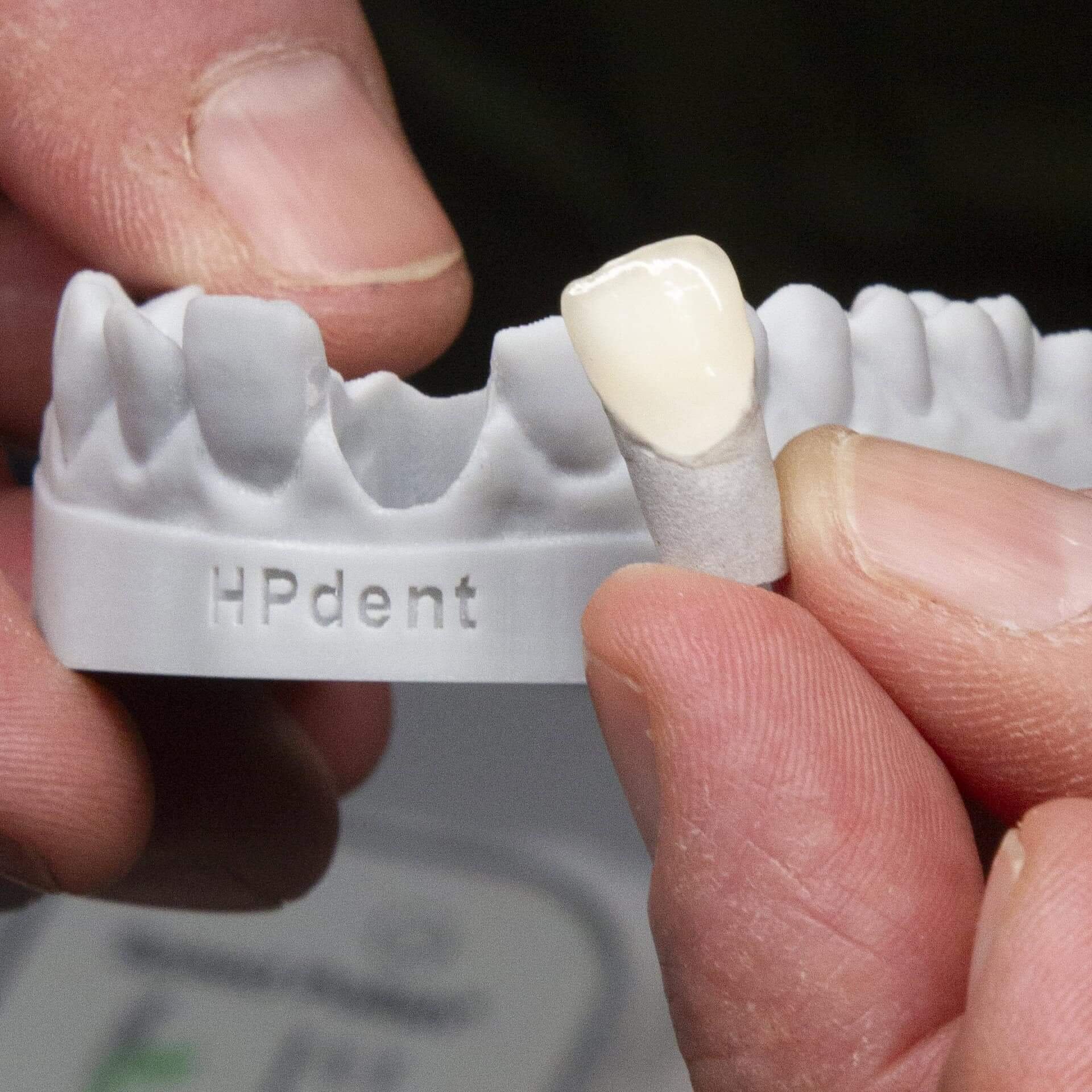 exemplificare de lucrare realizata cu discul refractar TriVest CAM in laboratorul de tehnica dentara