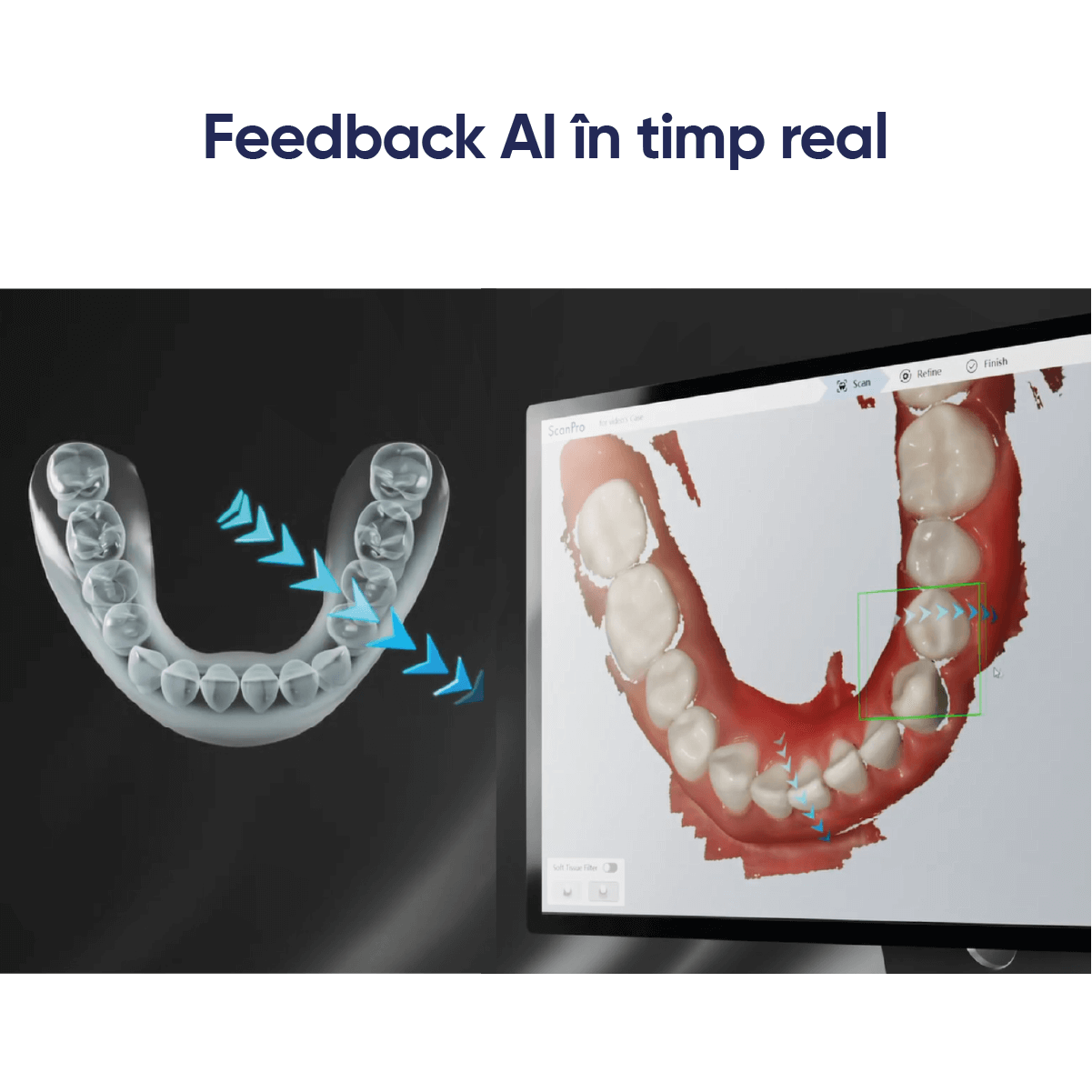 feedback in timp real scaner intraoral alliedstar sensa