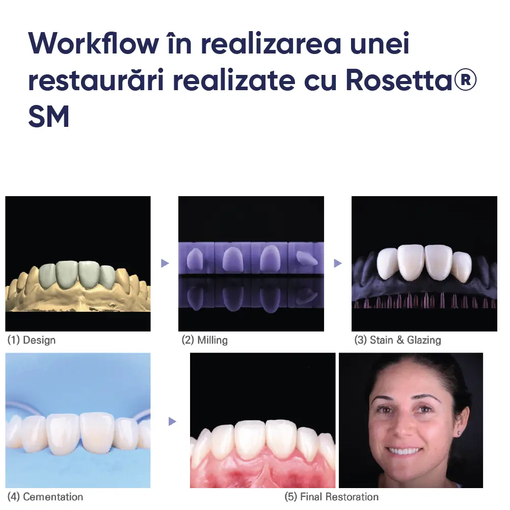 prezentare pe pași si evidentiare workflow cu Rosetta SM