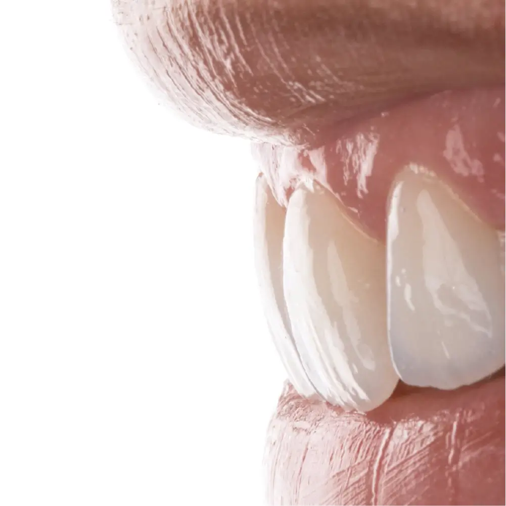 doua buze și o lucrare de aproape realizata cu rosetta SM