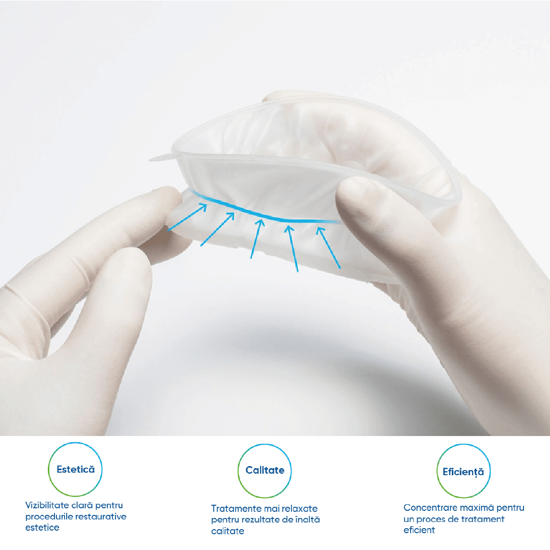 optragate 2 - informatii despre produs