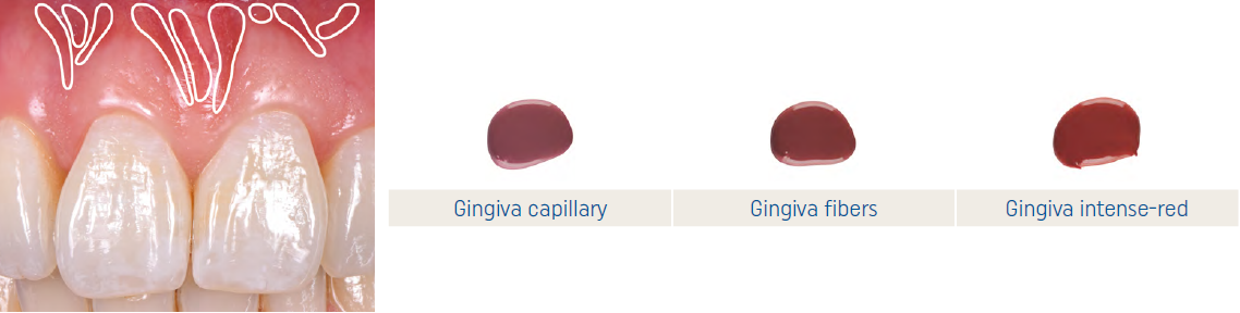 IPS e.max Ceram Art Illusion Gingiva capillary.