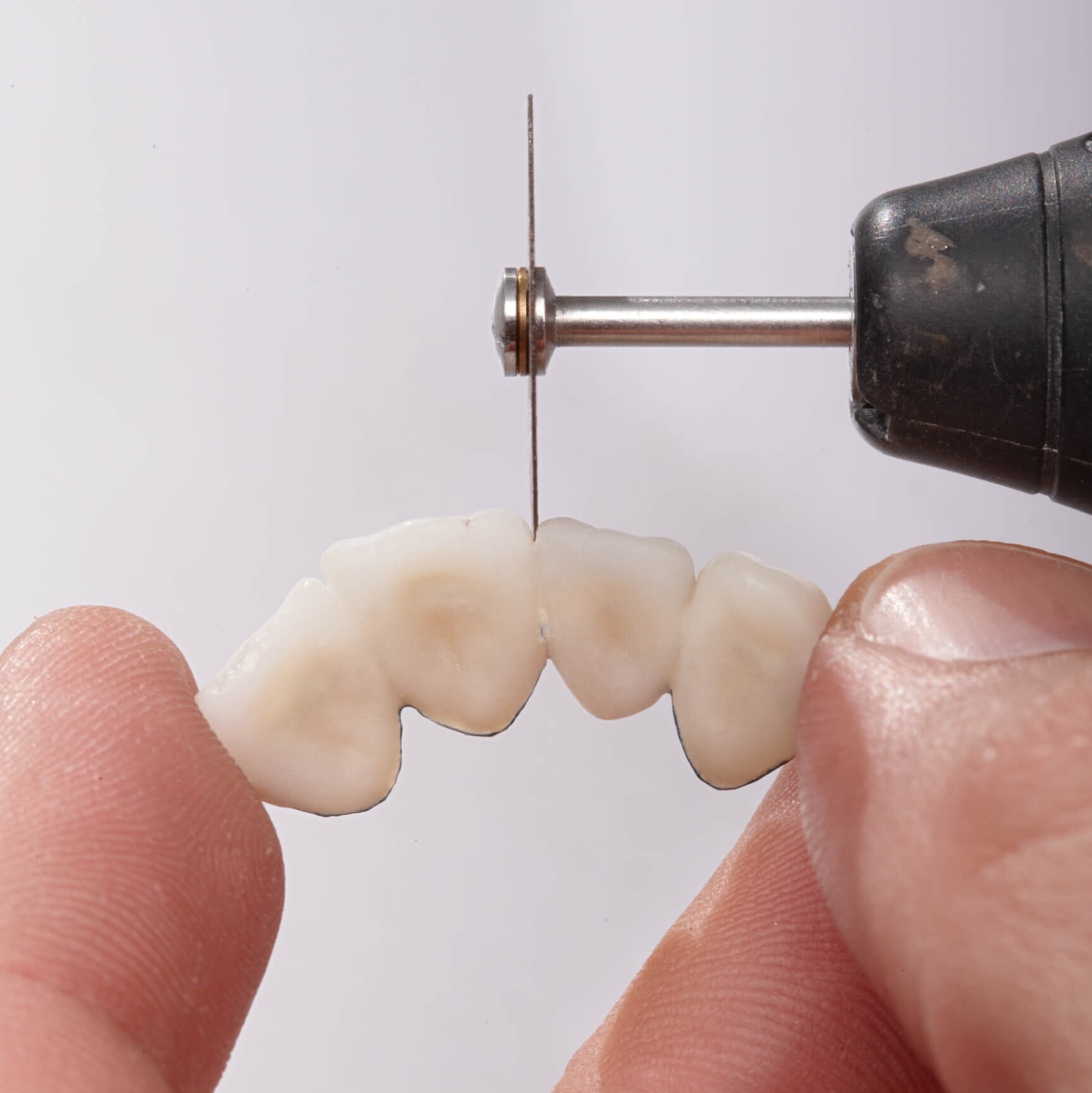 taierea si separarea unei lucrari cu discul separator dynex brillant in laboratorul de tehnica dentara