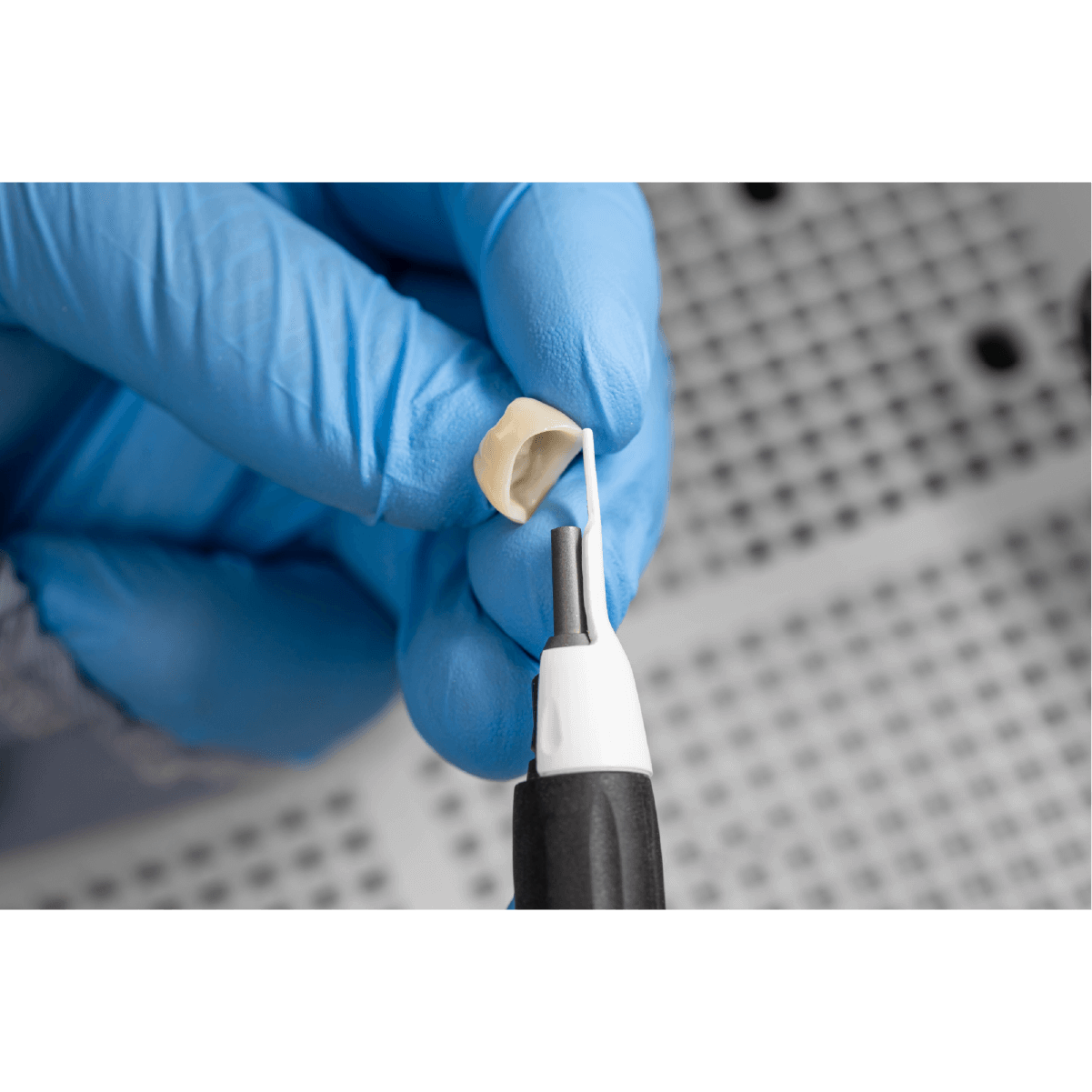 coroana dentara sablata cu prebonder in cabinetul stomatologic