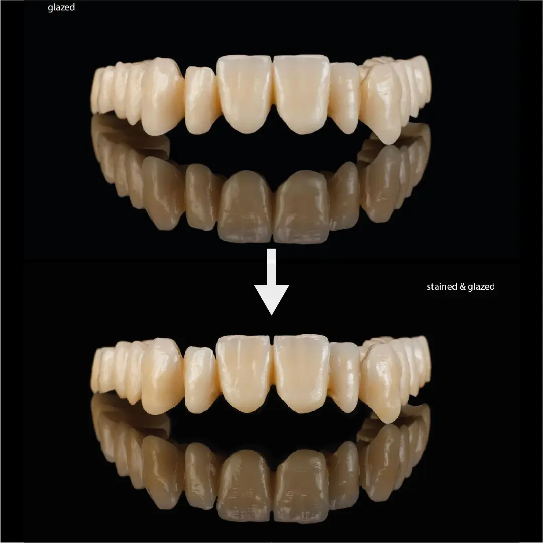 proces de lucru simplificat al lucrarilor realizate cu discutl de zirconiu cercon ht ML