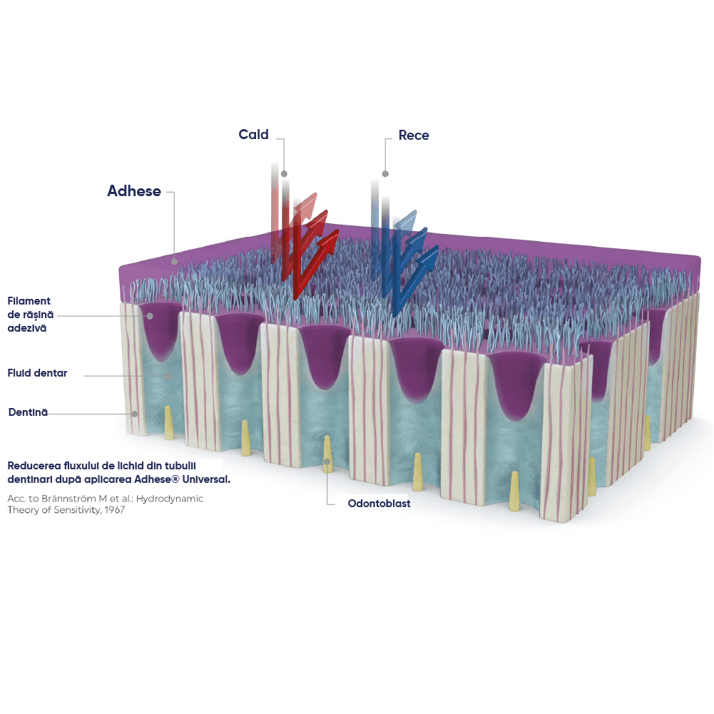 grafic cu efectul desensibilizant al adezivului universal adhese universal ivoclar