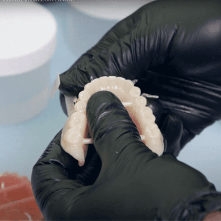 model dentar printat 3D cu rasina lucitone tinuta in maini de un tehnician dentar
